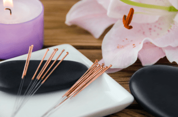 The Top 5 Health Benefits of Acupuncture